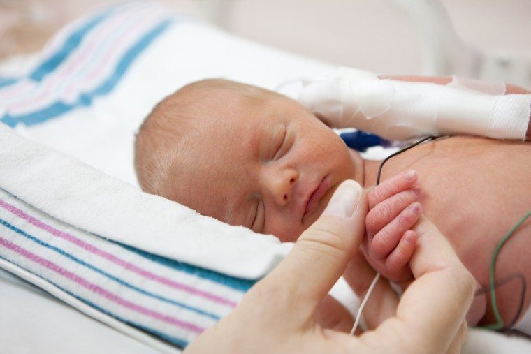 Bebés prematuros: ¿Qué cuidados necesitan?