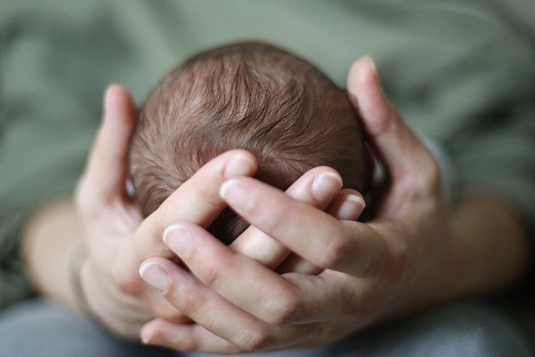 Mollera sumida: ¿Qué es y cuándo preocuparse?